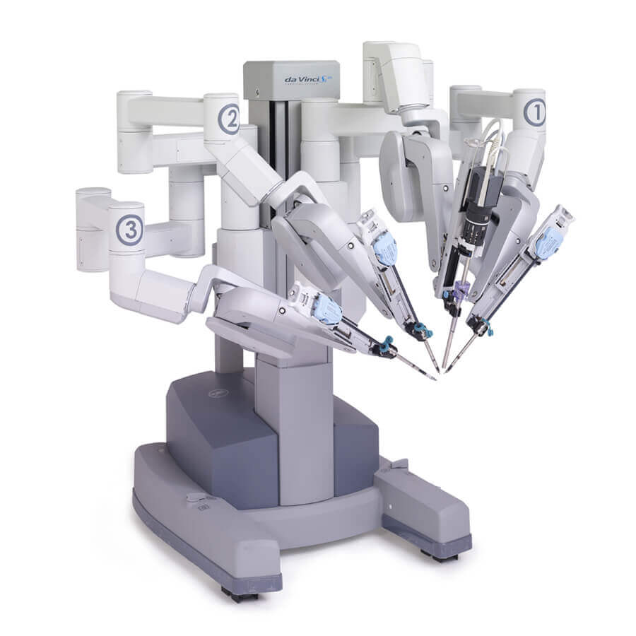 equipamento-cirurgia-robotica-2 (1) Cirurgia Urológica por Robô